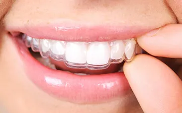 Invisalign Orthodontics