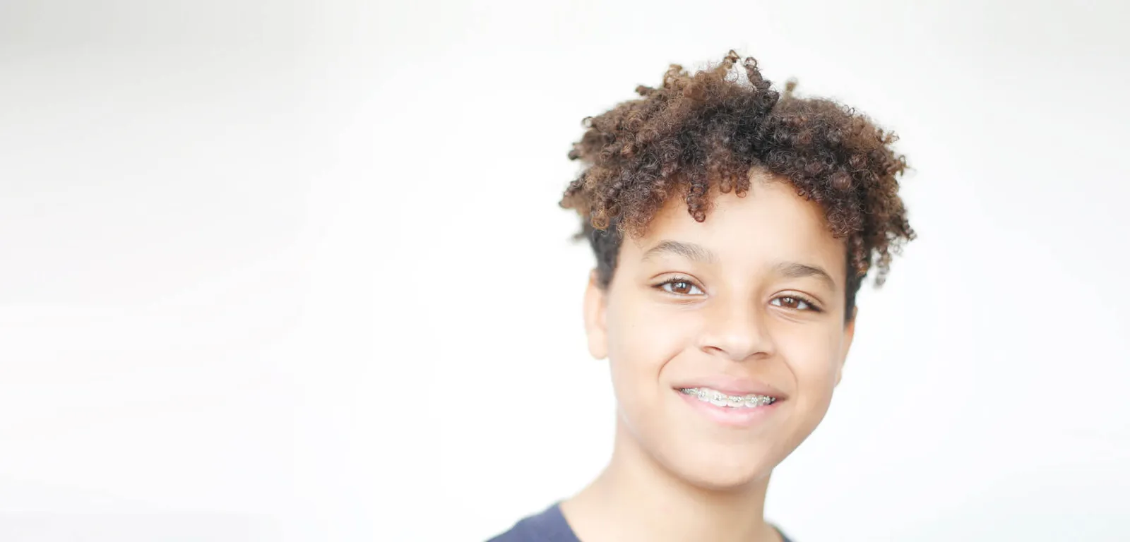 High quality Orthodontics In South West London Low visibility braces