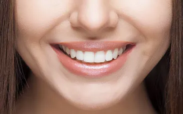 Smile Makeovers