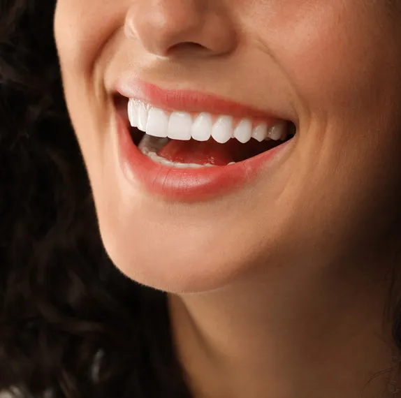 Is composite bonding the right choice for you?